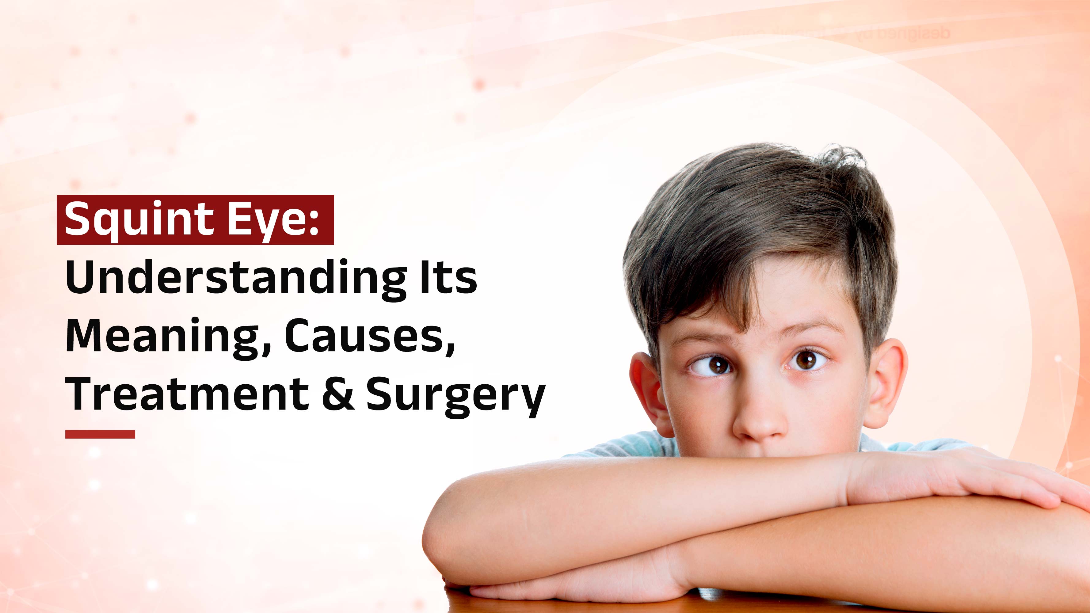 Causes of Squint